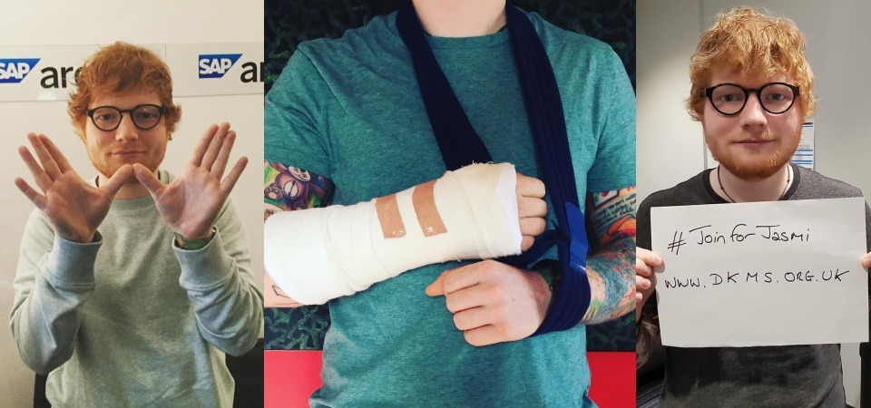 週日亞洲首站恐有變數！Ed Sheeran 紅髮艾德車禍摔傷手臂，粉絲們請密切注意最新消息