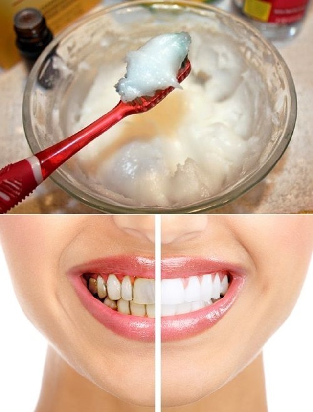 Можно чистить зубы в рамадан зубной пастой. Зубная паста. Отбеливание зубов. Сода пищевая для зубов. Зубная паста с содой для зубов.