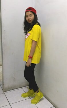 黑眼圈重到像凹陷
